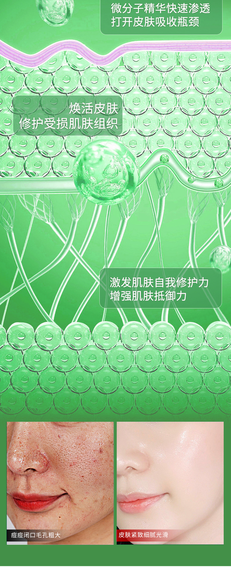 乐尚妆美白祛痘精华液详情页1_04