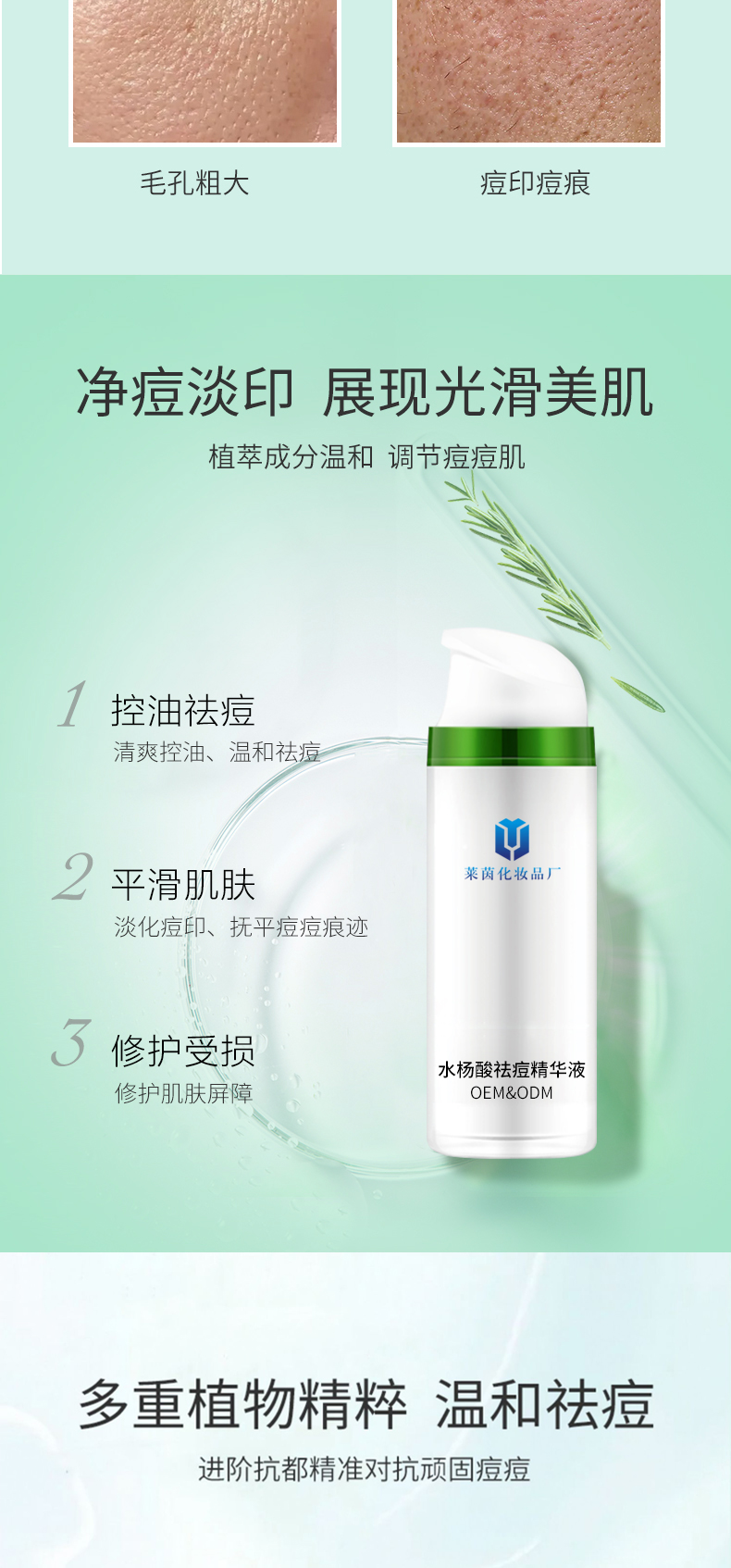 水杨酸祛痘精华液详情页_02