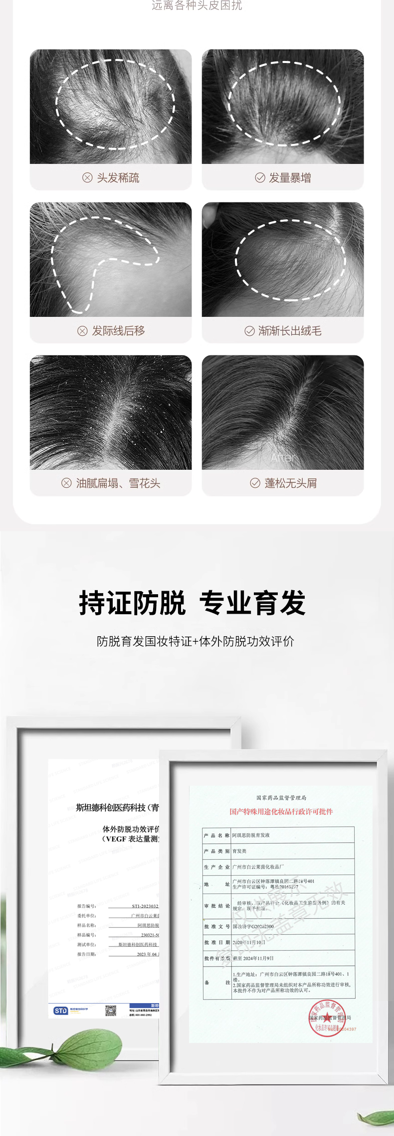 阿琪思防脱育发液详情页_05