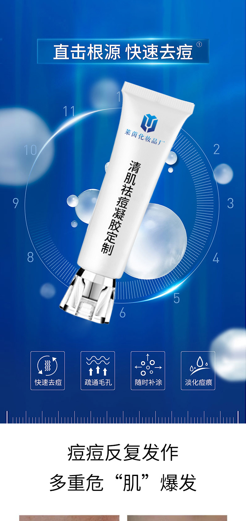 清肌祛痘凝胶详情页_01