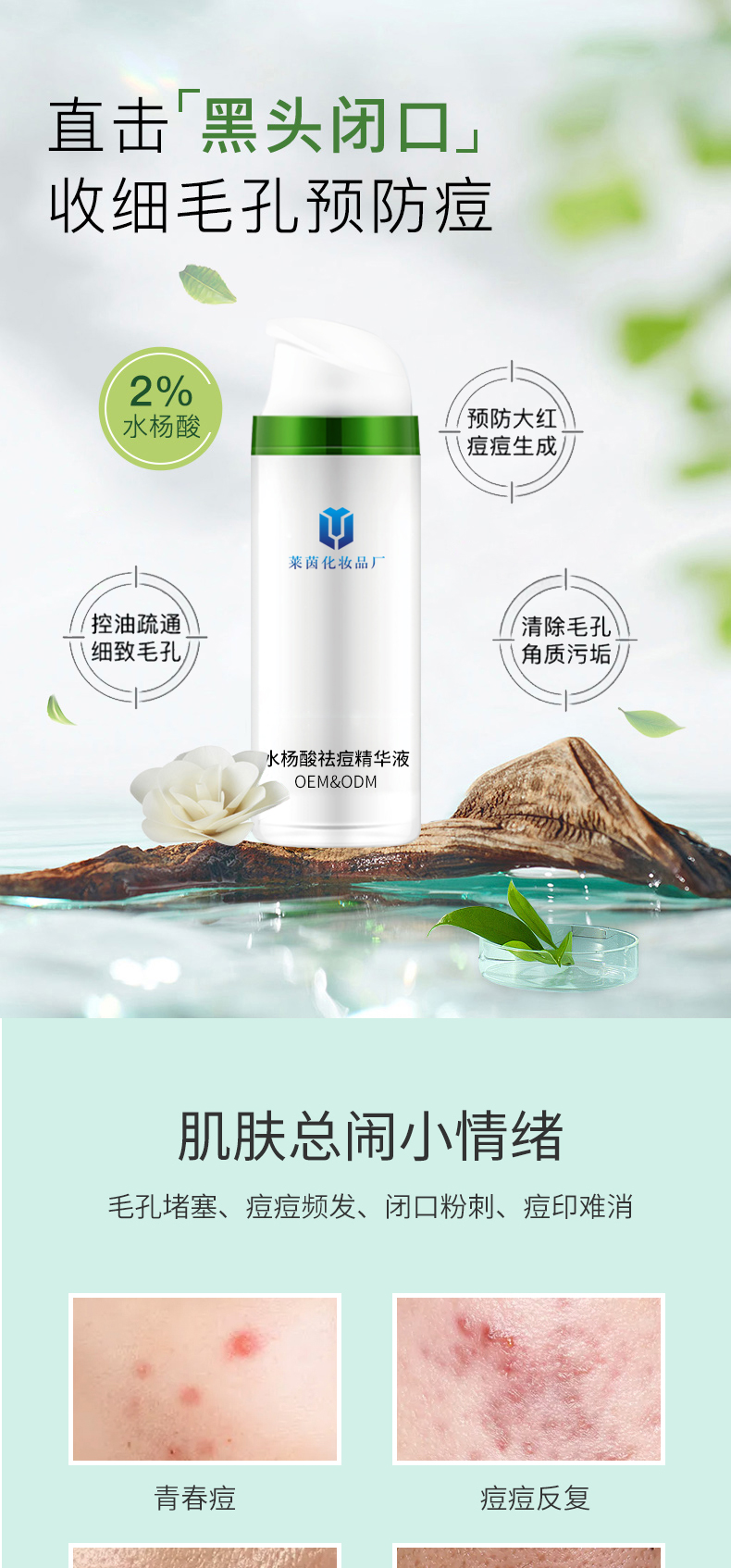 水杨酸祛痘精华液详情页_01